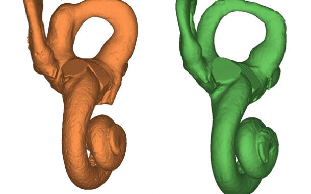 Un estudio español demuestra por primera vez que los neandertales cuidaban y protegían a sus niños con síndrome de Down